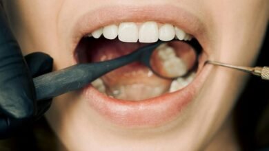 dentist checking teeth of a person